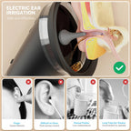 Electric Ear Wax Removal