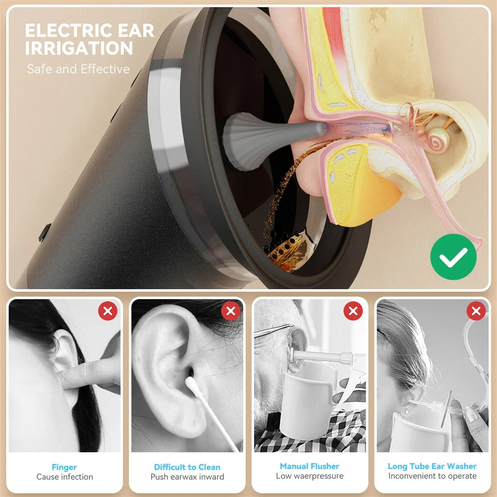 Electric Ear Wax Removal